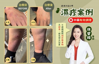 【濕疹_陳先生】案例分享｜澄玥中醫 徐碧韓 醫師
