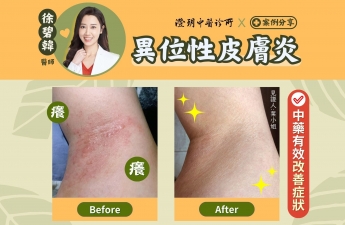 【異位性皮膚炎_葉小姐】案例分享｜澄玥中醫 徐碧韓 醫師
